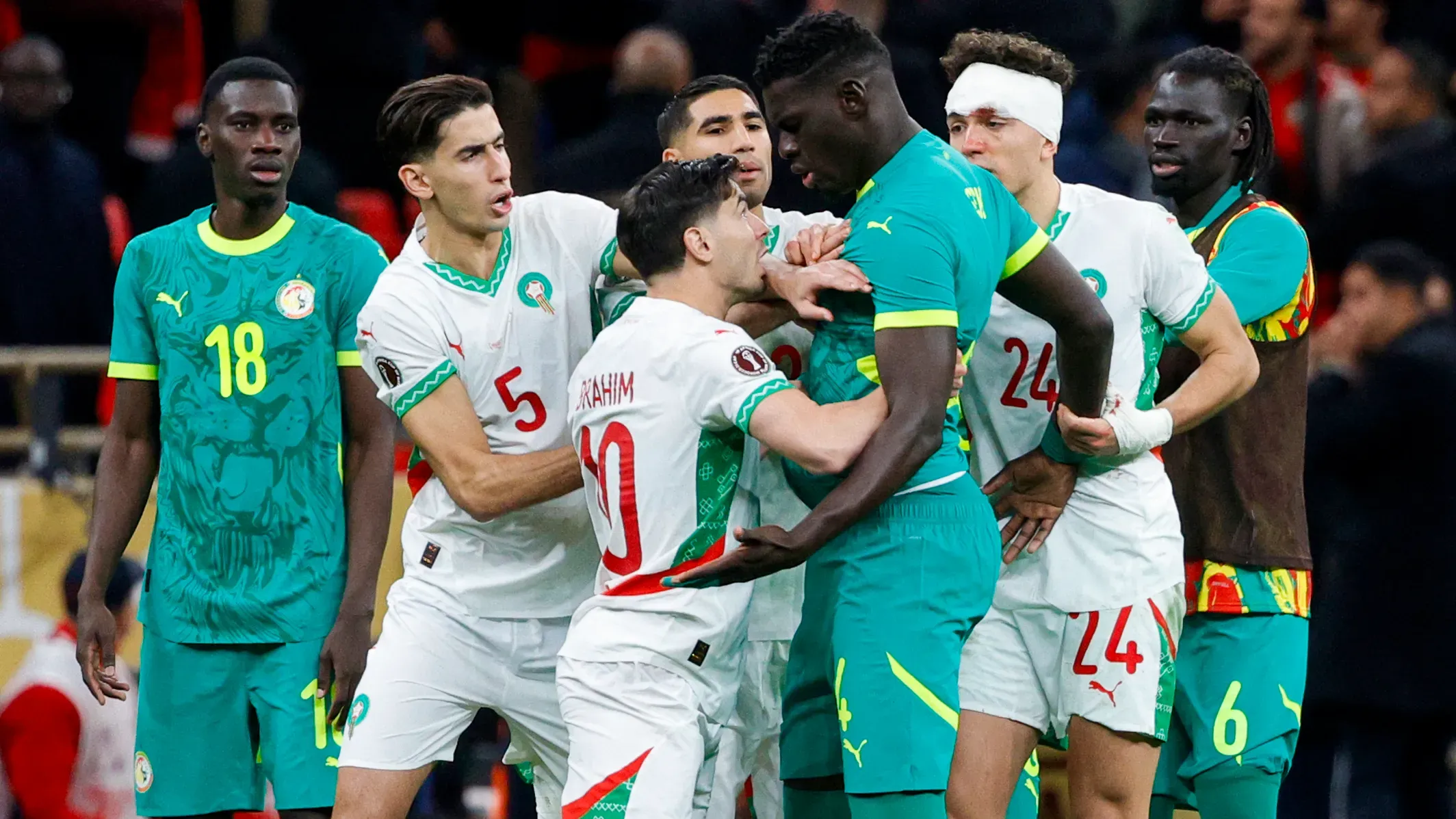 Urgent Surgery for Moroccan Star Ahead of World Cup