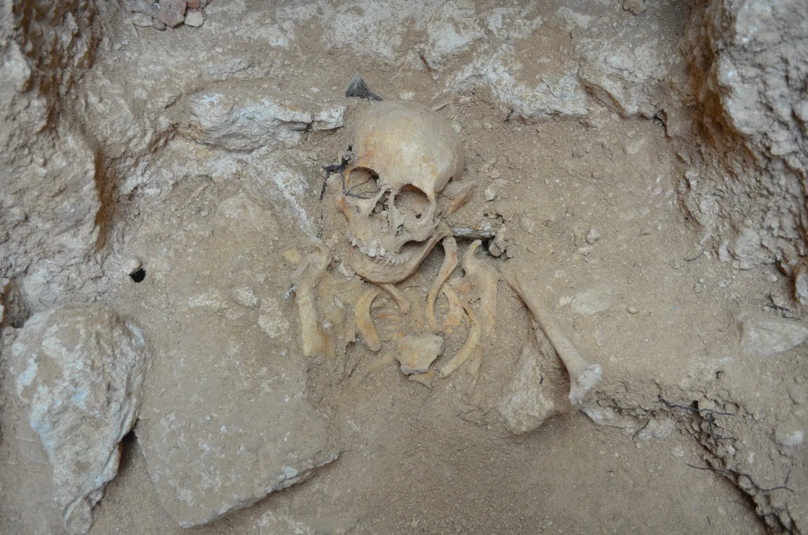 Unveiling the Past: Reconstruction of a Young Woman's Skeleton Found in Rabat Catacombs