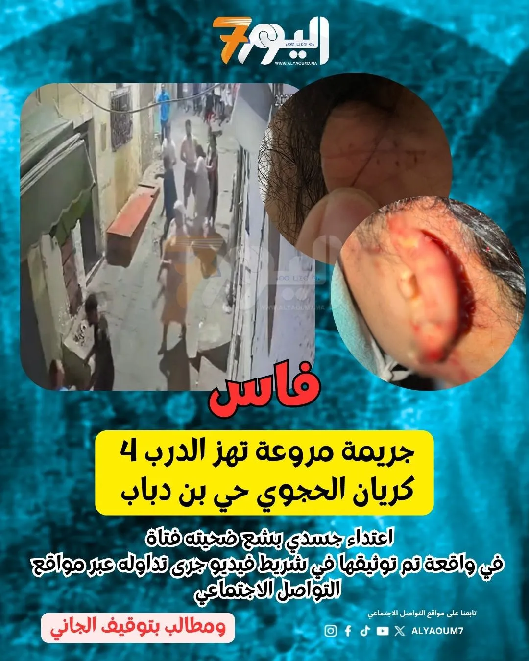 Shocking Assault in Fez: Teen Arrested for Attempted Murder of Young Woman