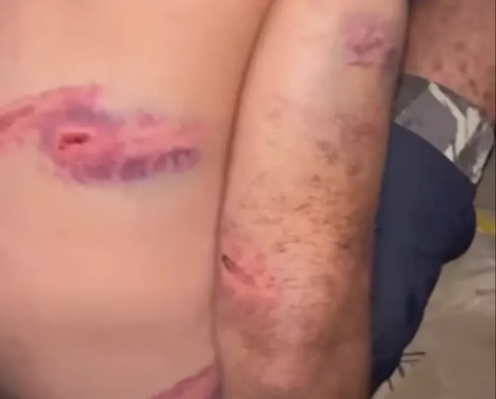 Allegations of Abduction and Torture by Spanish Military Against Moroccan Migrant