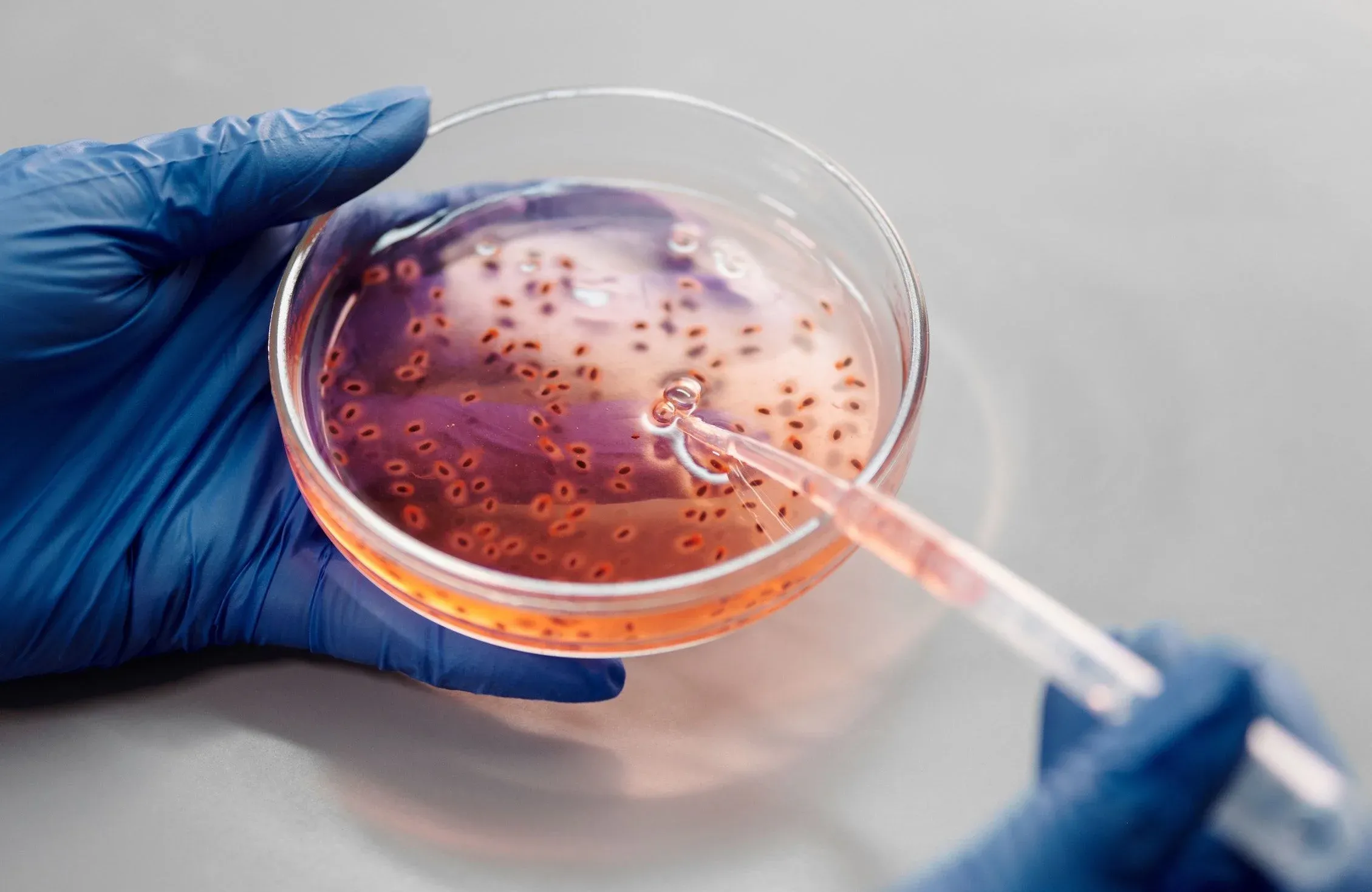 Suspected Diphtheria Outbreak in Agadir Following Deaths of Two Brothers